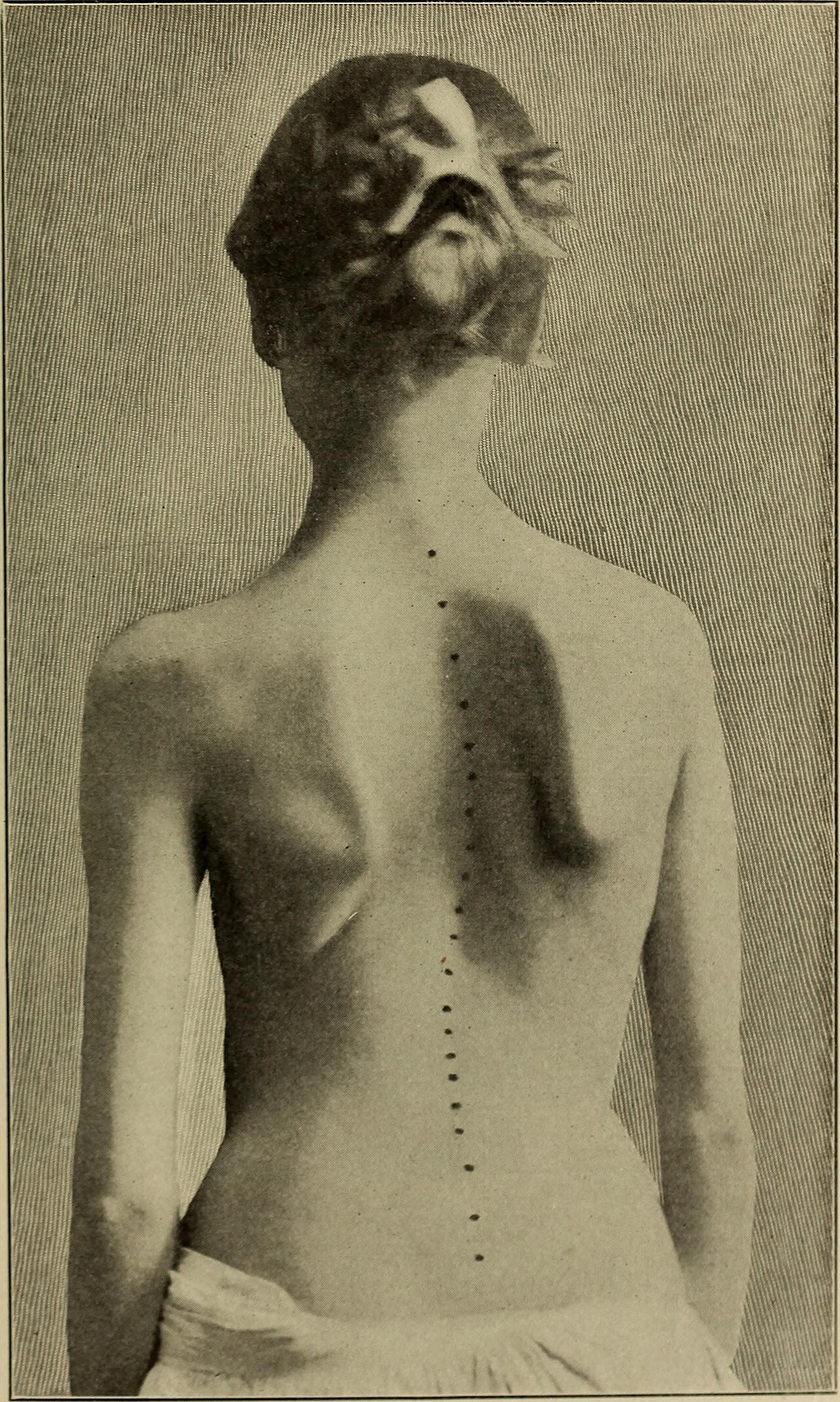 Orthopedic surgery