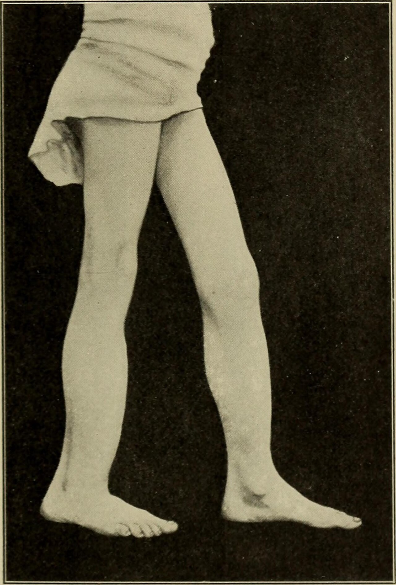 Orthopedic surgery