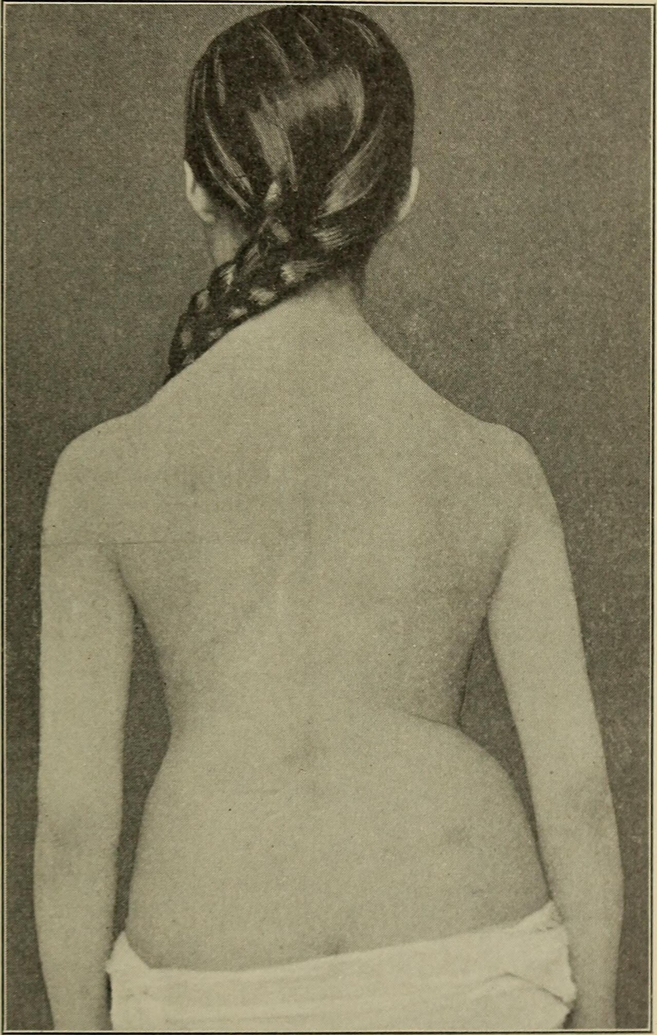 Orthopedic surgery