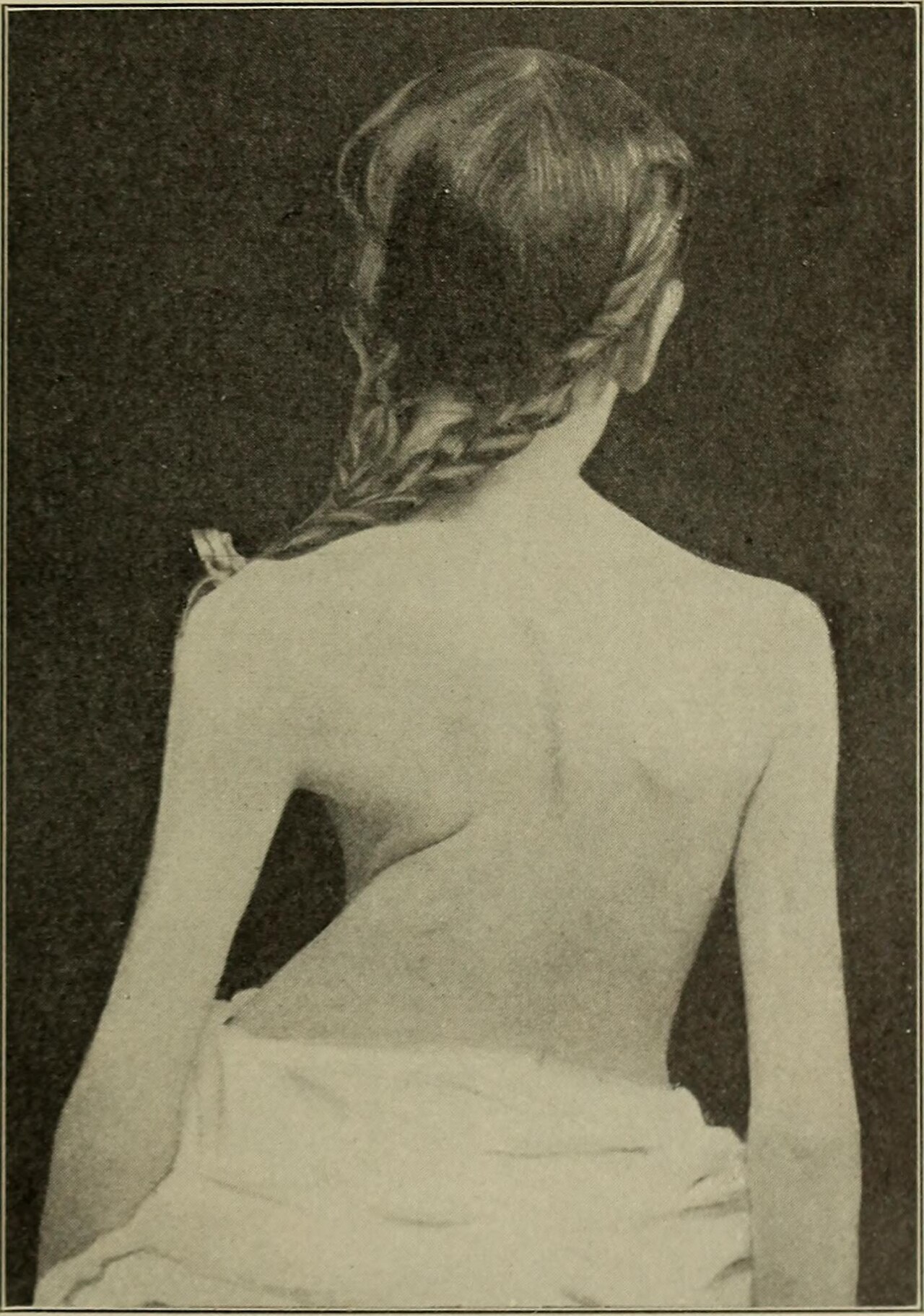Orthopedic surgery