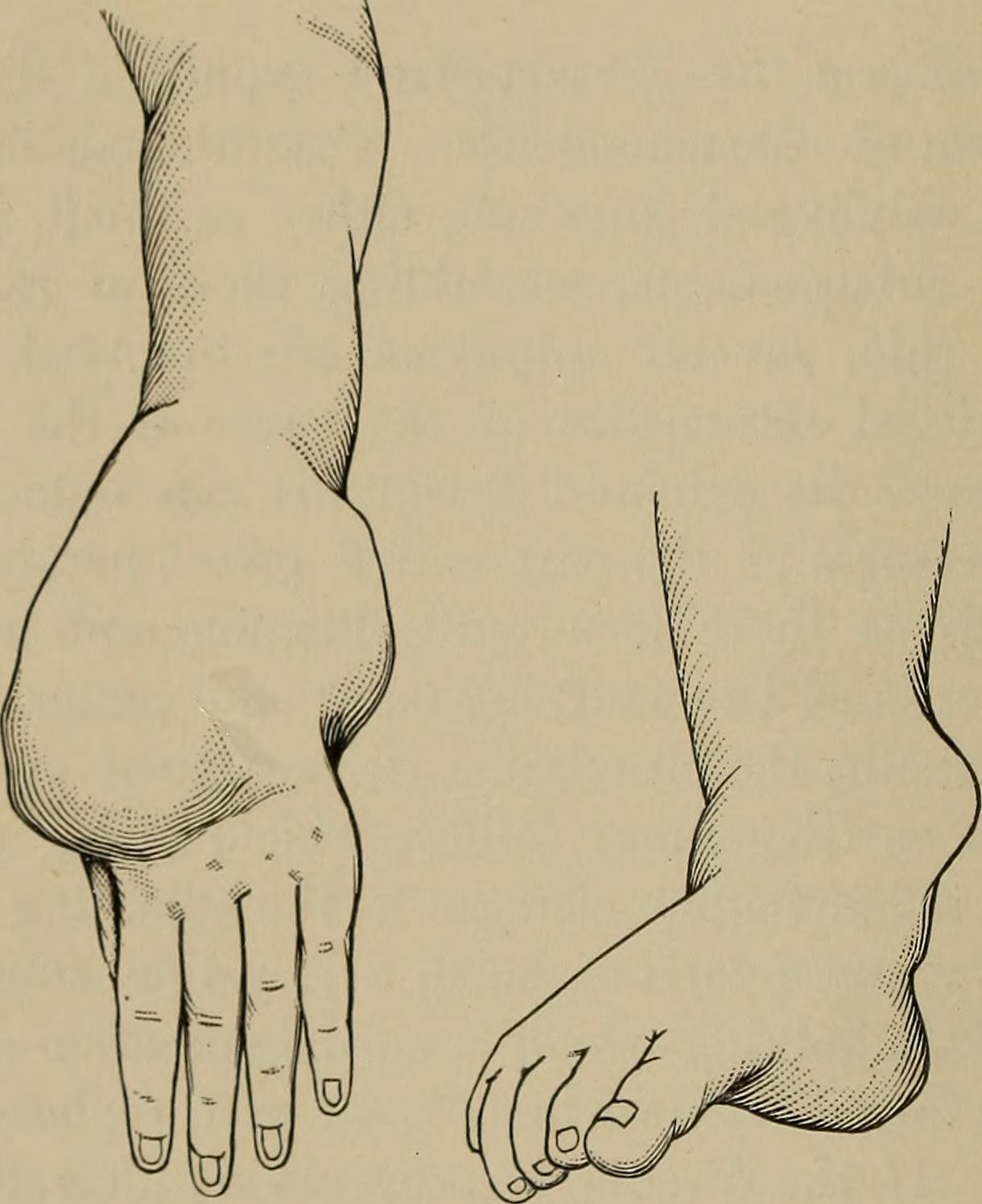 Orthopedic surgery