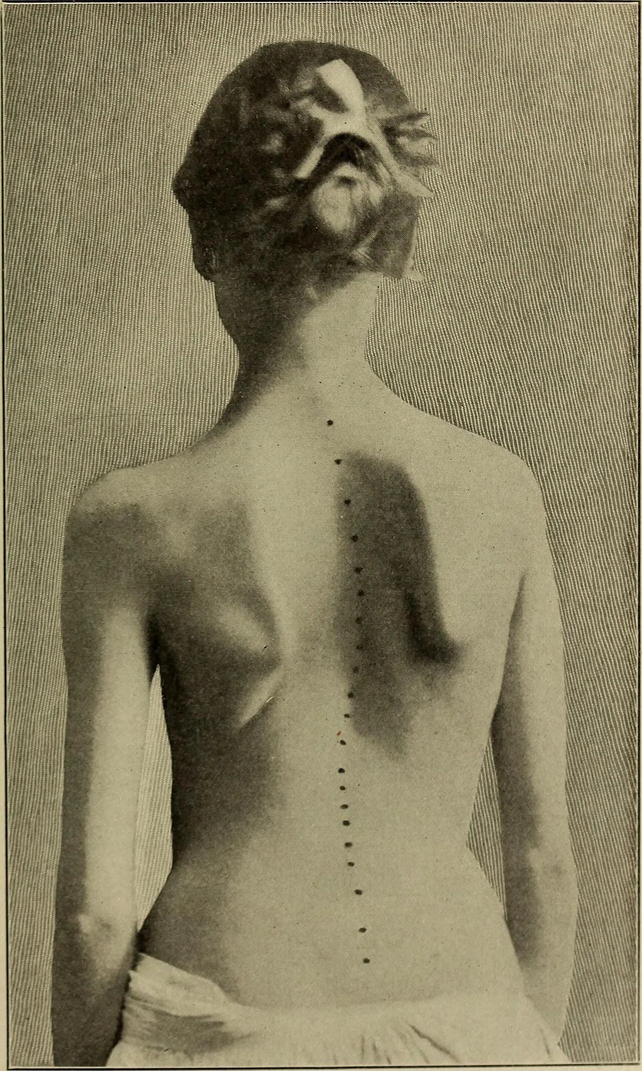 Orthopedic surgery