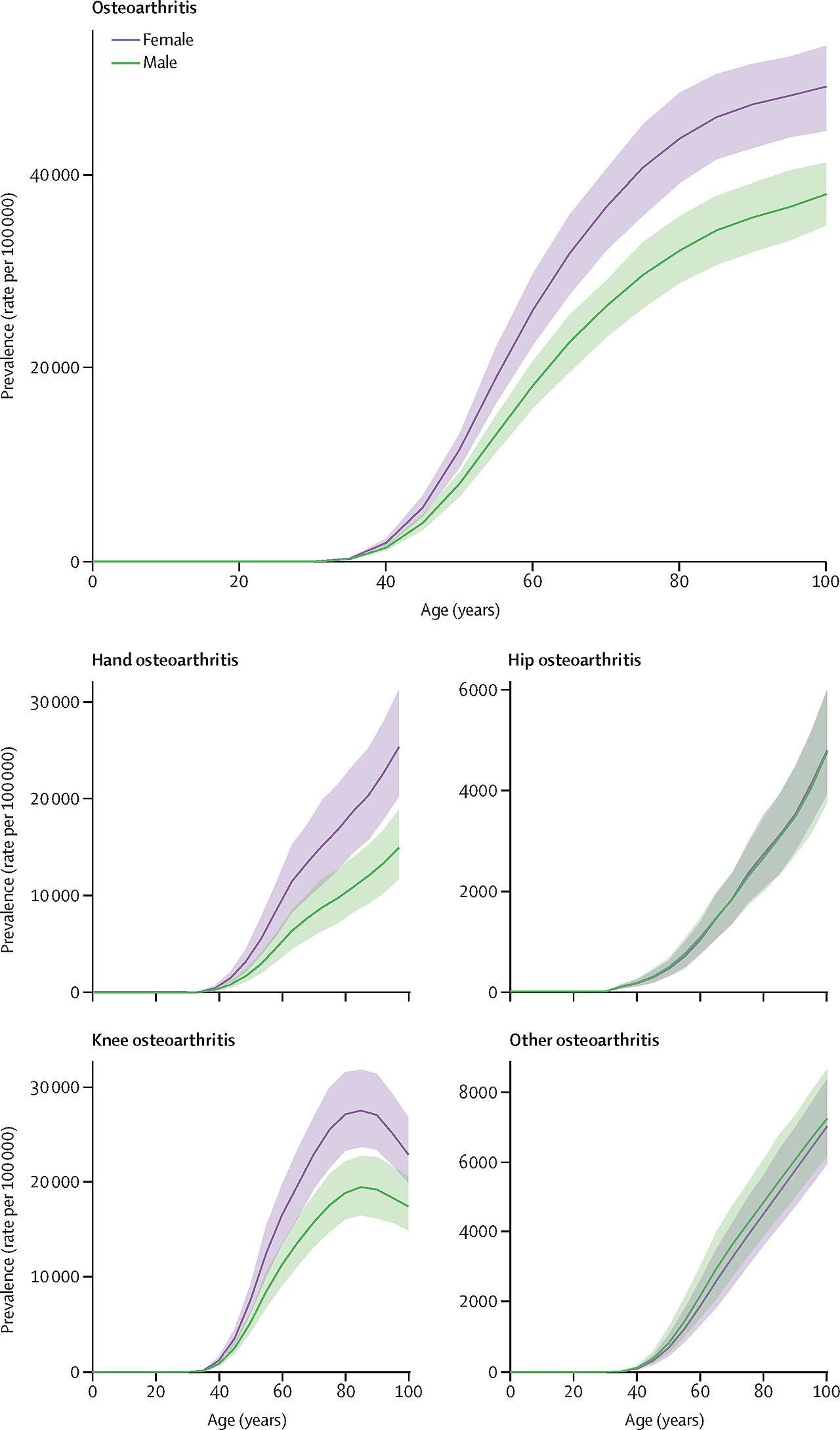 Osteoarthritis