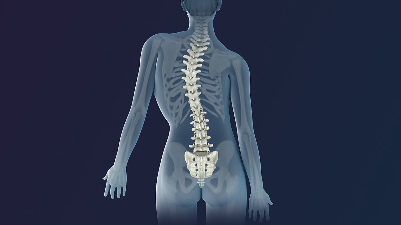 Scoliosis