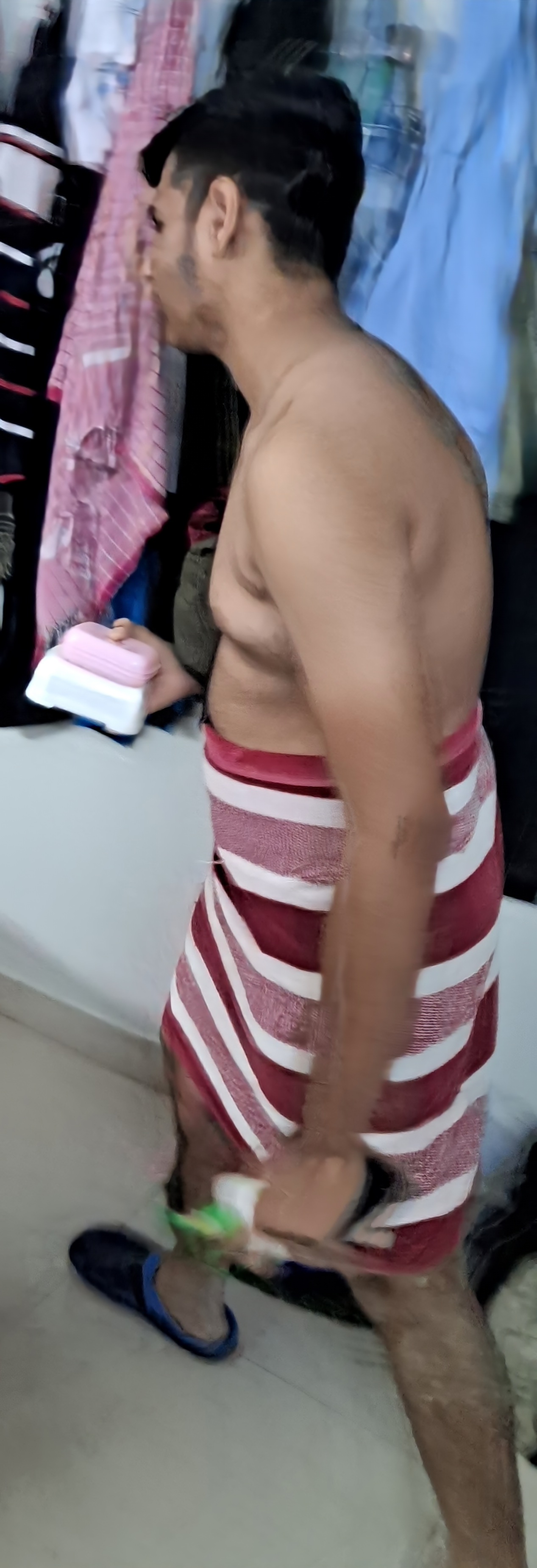 Scoliosis