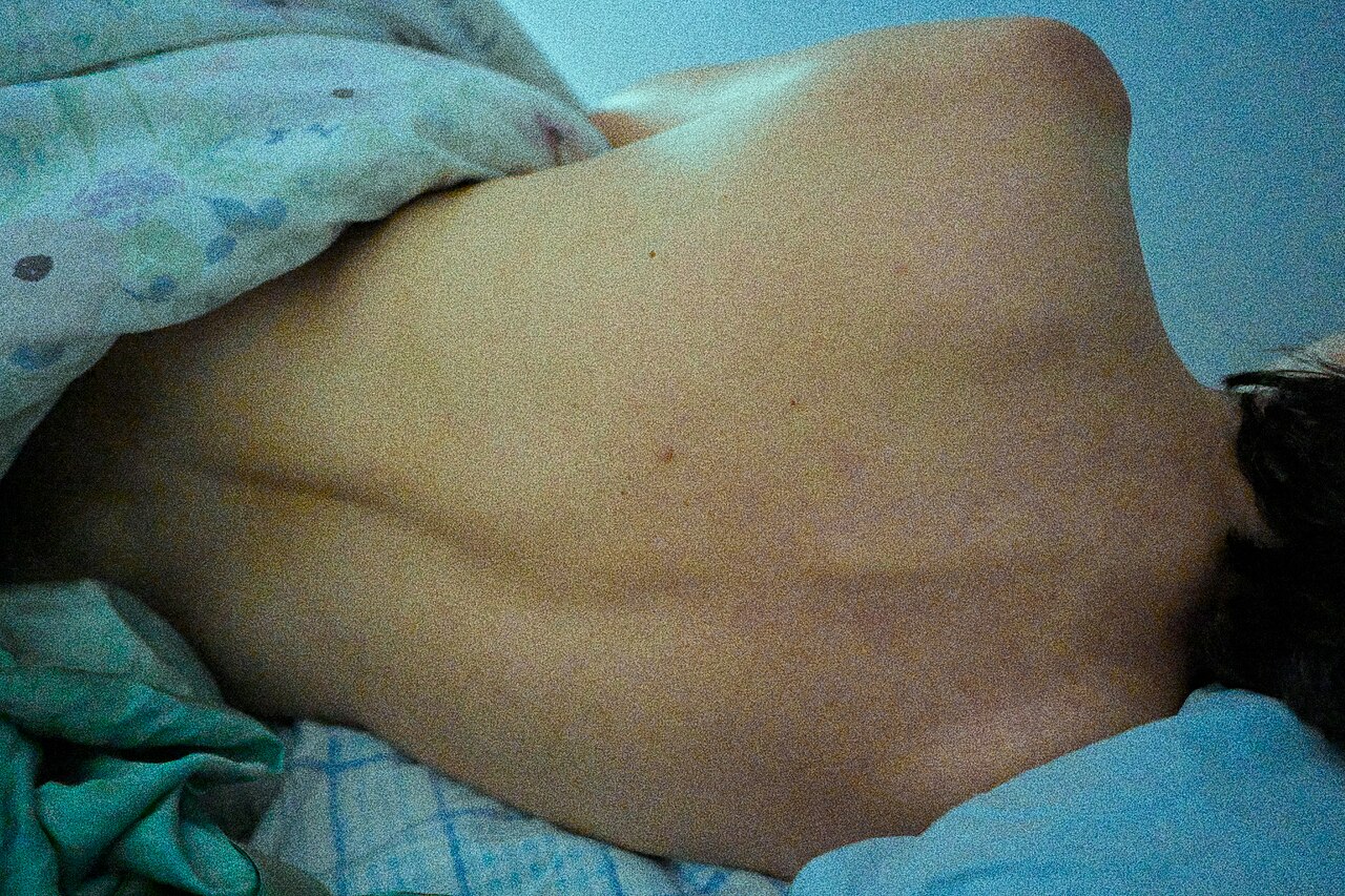 Shoulder